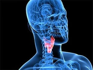 Larenjit (Akut larenjit)