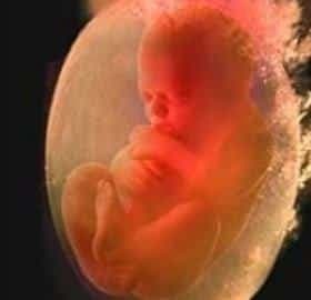 Amniyotik Sıvı (Amnion Sıvısı) Hastalıkları