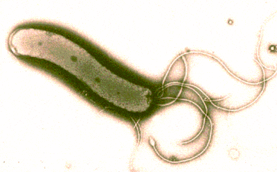 Helicobacter Pylori Diyeti