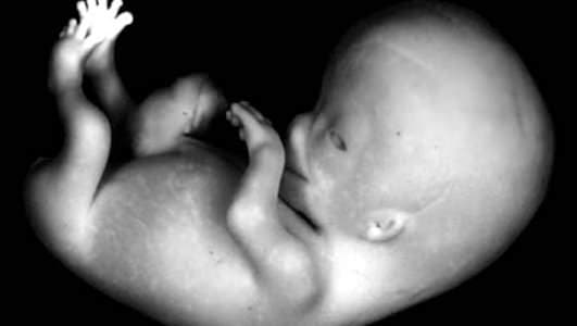 Cinsiyette Belirsizlik