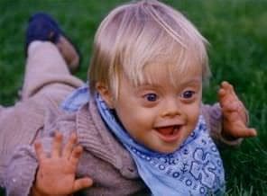 Süper Dişi Hastalığı Nasıl Anlaşılır