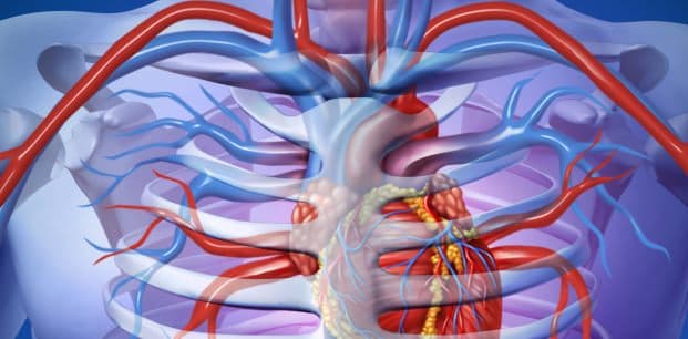 Ventriküler Septal Defekt (VSD)