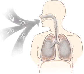 Karbon Monoksit Zehirlenmesi