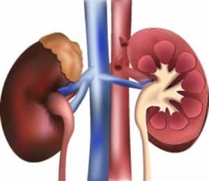 İdrar Söktürücüler ve İdrar Söktürücü yan etkileri