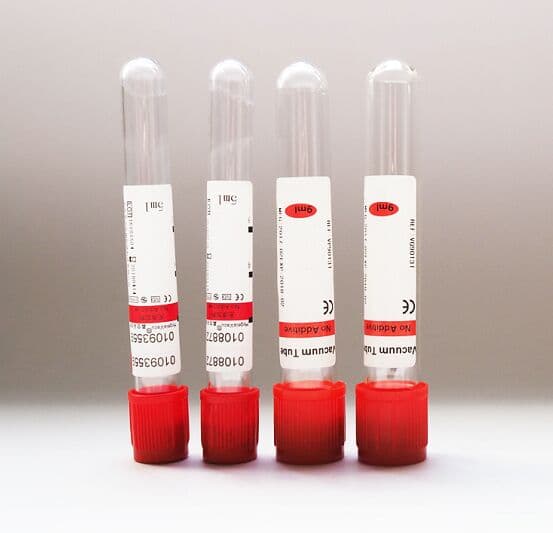 Kan Biyokimya Tetkikleri (Tahlilleri)