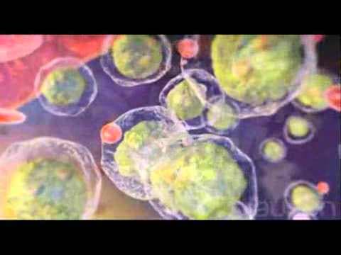 Lösemi (Erişkinde)