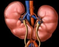 Polikistik Böbrek Hastalığı (Otozomal Dominant )