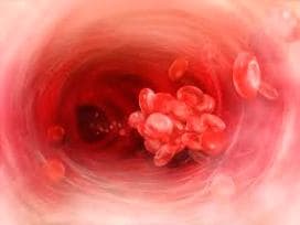 Pıhtılaşma Bozuklukları