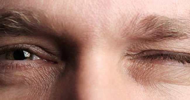 Göz Seyirmesi Neden Olur? Nasıl Geçer?
